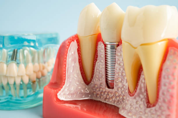 Our Range of Dental Services in Casa De Oro Mount Helix, CA